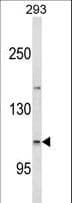 Polyclonal Rabbit anti-Human ESPN / Espin Antibody (aa17-45, IHC, WB)
