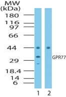 IHC-plus™ C5AR2 / GPR77 / C5L2 Antibody (aa1-50)