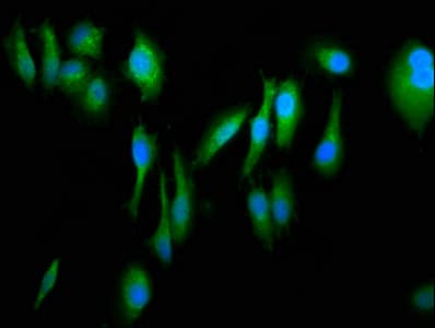 Polyclonal Rabbit anti-Human FERMT1 / Kindlin Antibody (IHC, IF)