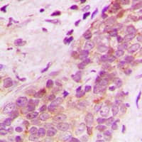 Polyclonal Rabbit anti-Human MAGI2 / AIP-1 Antibody (Internal, IHC, WB)