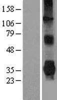 PARK2 / Parkin 2 Protein (Over-Expression Lysate Myc-DDK (Flag))