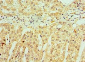 HSD11B1 / HSD11B Antibody (aa25-292)