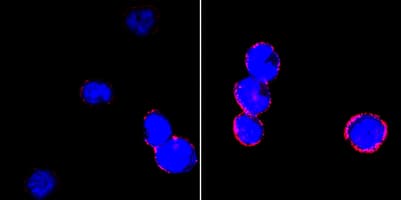 Monoclonal Mouse anti-Human ITGB2 / CD18 Antibody (clone 1E+13, IF)