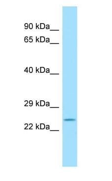 Polyclonal Rabbit anti-Rat SCN1B Antibody (aa58-107, WB)