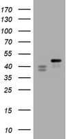 TIA-1 Antibody (clone OTI1C3)