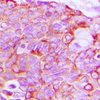 ERBB3 / HER3 Antibody (C-Terminus)