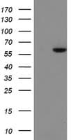 FTCD / 58K Golgi Protein Antibody (clone OTI4A1)