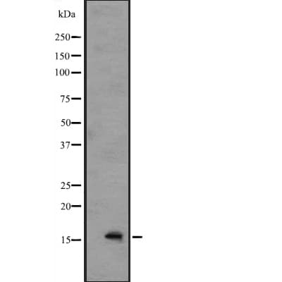 IL36B Antibody
