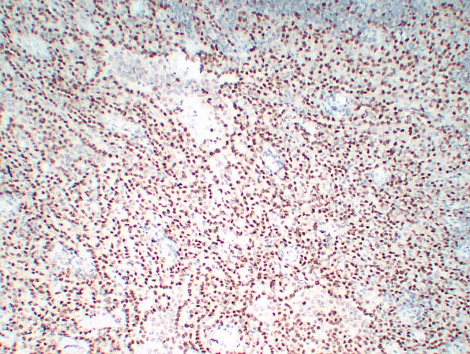WT1 / Wilms Tumor 1 Antibody (clone ABT-WT1)