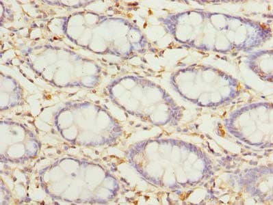 Polyclonal Rabbit anti-Human COLGALT2 / GLT25D2 Antibody (IHC, WB)