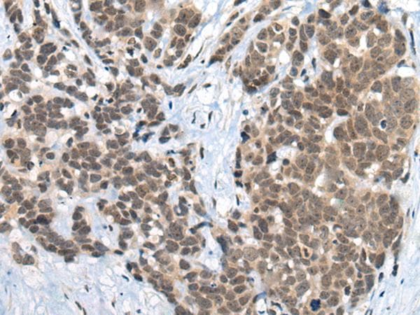 ZNF83 / HPF1 Antibody