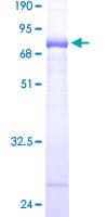 Human PHKG1 Protein (Recombinant GST)