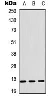 CFL1 / Cofilin Antibody (Internal)