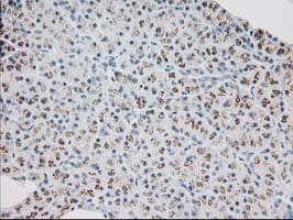 MGLL / Monoacylglycerol Lipase Antibody (clone OTI1C6)