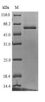 Human UGT1A4 Protein (Recombinant 6His, N-terminus)