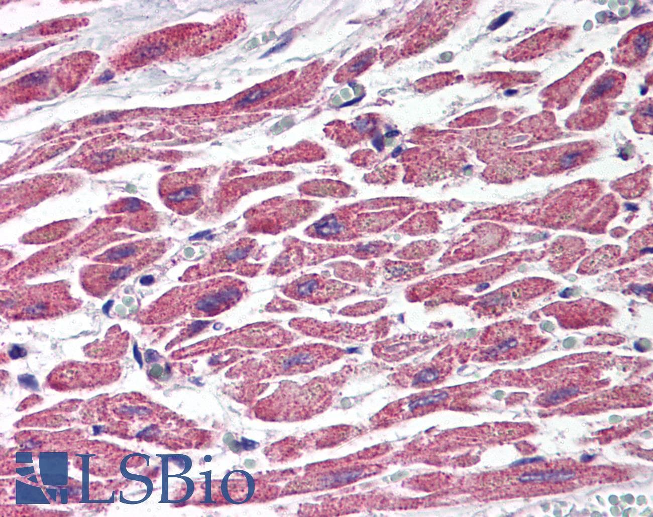 IHC-plus™ Hamartin / TSC1 Antibody
