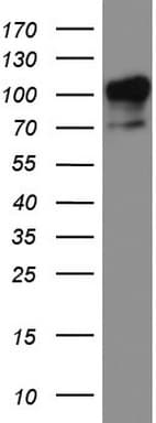 MCAM / CD146 Antibody (clone UMAB155)