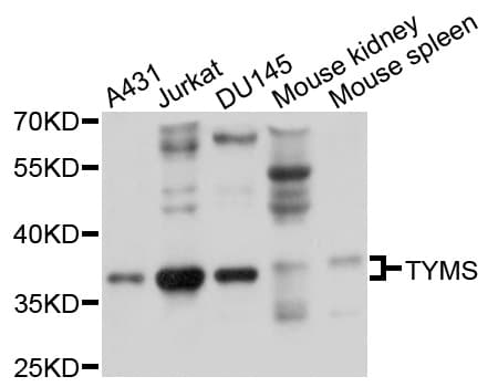 TS / Thymidylate Synthase Antibody