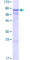Human SRP54 Protein (Recombinant GST)