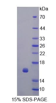 Human CDK2AP1 / DOC1 Protein (Recombinant)