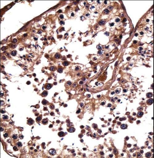 Polyclonal Rabbit anti-Human NANOS1 / NOS1 Antibody (aa96-124, IHC, WB)