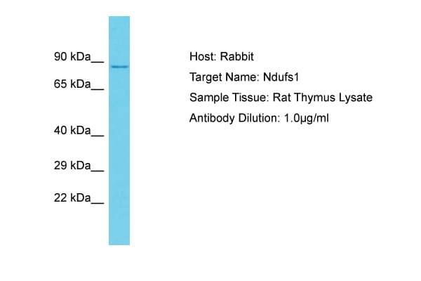 NDUFS1 Antibody (aa88-137)