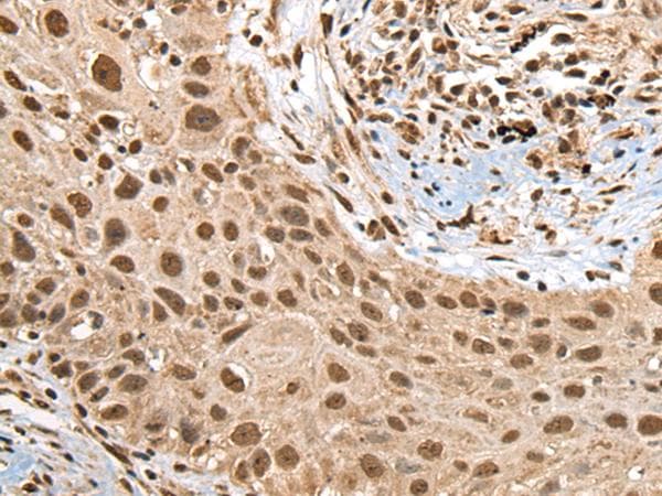 RTCB / C22orf28 Antibody