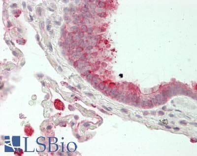 IHC-plus™ Polyclonal Rabbit anti-Human FOLR1 / Folate Receptor Alpha Antibody (IHC, WB)