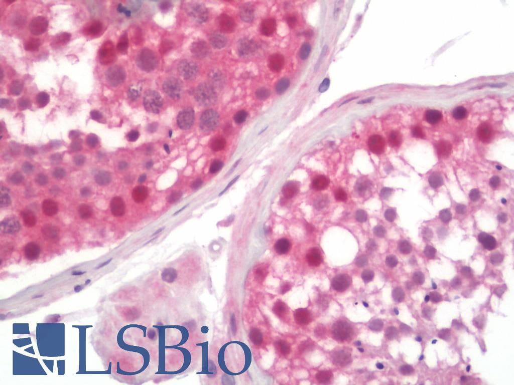 IHC-plus™ GATAD2A Antibody (aa573-633)