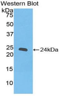 IFN Gamma / Interferon Gamma Antibody (aa22-186)