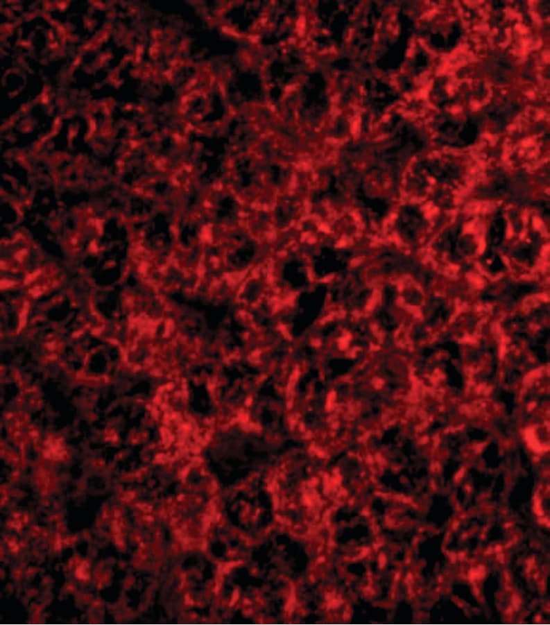 PathPlus™ Polyclonal Rabbit anti-Human TRAF2 Antibody (IHC, IF, WB)
