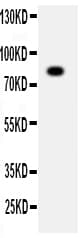 ADAM2 / Fertilin Beta Antibody (aa701-715)
