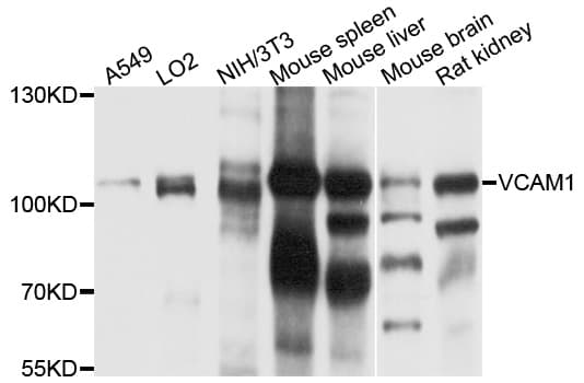 Polyclonal Rabbit anti-Human VCAM1 / CD106 Antibody (WB)