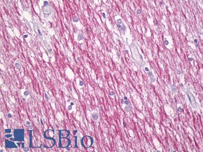 IHC-plus™ Polyclonal Rabbit anti-Human OMG / OMGP Antibody (aa282-331, IHC)