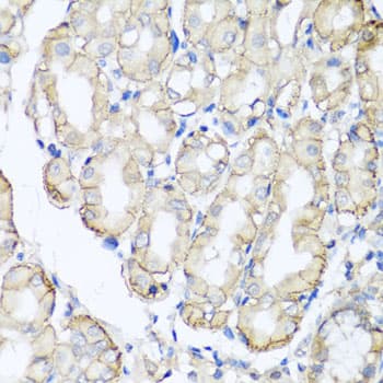 AHCYL1 / DCAL Antibody