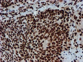 Monoclonal Mouse anti-Human PADI4 / PAD4 Antibody (clone OTI4H5, IHC, IF, WB)
