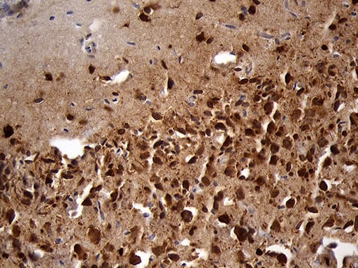 EEF1D Antibody (clone OTI6B3)