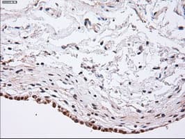 ACTN1 Antibody (clone OTI7A4)
