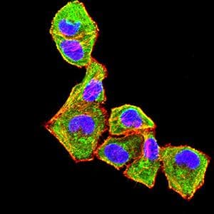 CXCR2 Antibody (clone 5F7A11)