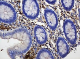 TP / Thymidine Phosphorylase Antibody (clone OTI1H7)