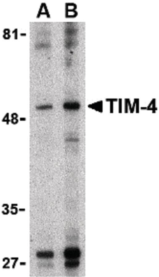 IHC-plus™ TIMD4 / TIM4 / TIM-4 Antibody