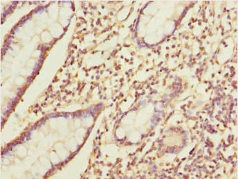 Polyclonal Rabbit anti-Human IKBIP Antibody (IHC, WB)