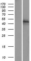 ZFP1 Protein (Over-Expression Lysate Myc-DDK (Flag))