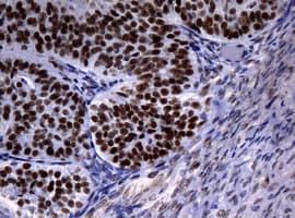 NBN / Nibrin Antibody (clone OTI2E9)