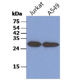 TBCB / CKAP1 Antibody (clone AT1F6)