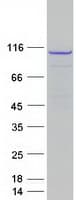 Human ERCC4 / XPF Protein (Recombinant Myc-DDK (Flag))