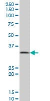 Monoclonal Mouse anti-Human PPA1 Antibody (clone 3B2, WB)