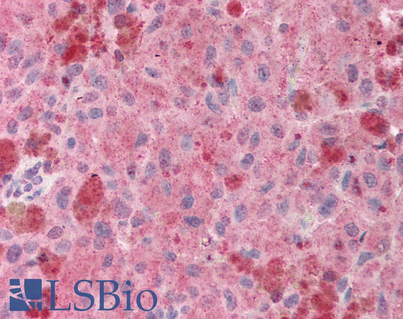Polyclonal Rabbit anti-Human POU5F1 / OCT4 Antibody (aa114-163, IHC, WB)