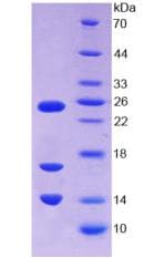 Human LL37 / Cathelicidin Protein (Recombinant His, N-Terminal)