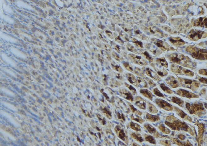 SDHA Antibody